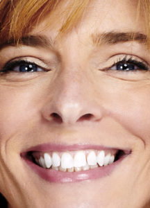 Best Dentist Apex NC