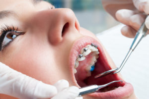 Dentists Cary NC
